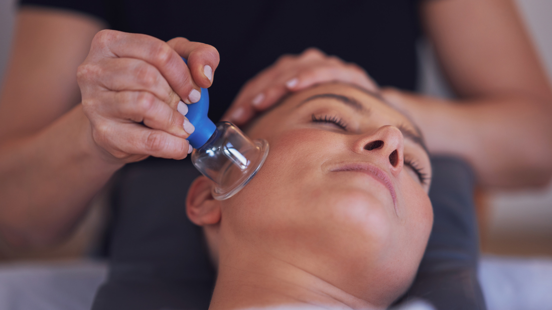 Ventuze chinezești Ventuze chinezești