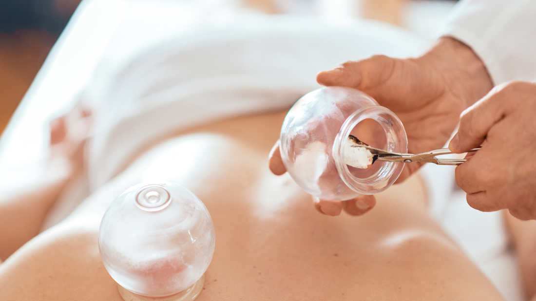 Ventuze chinezești Ventuze chinezești