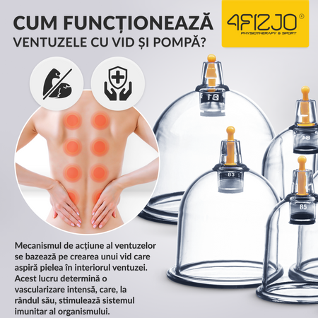 Ventuze chinezești cu vacuum, set 24 bucăți
