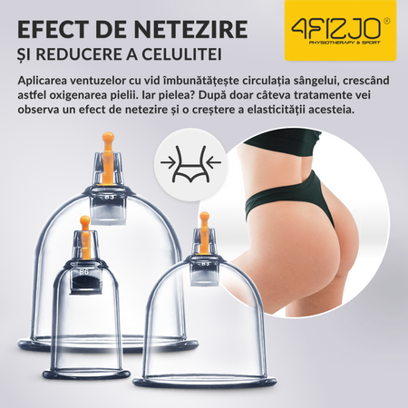 Ventuze chinezești cu vacuum, set 24 bucăți