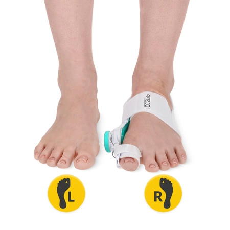 Corector pentru monturi, Hallux Valgus