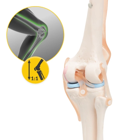Articulația genunchiului - model anatomic