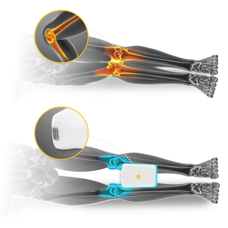 Pernă ortopedică între picioare SUPPORT