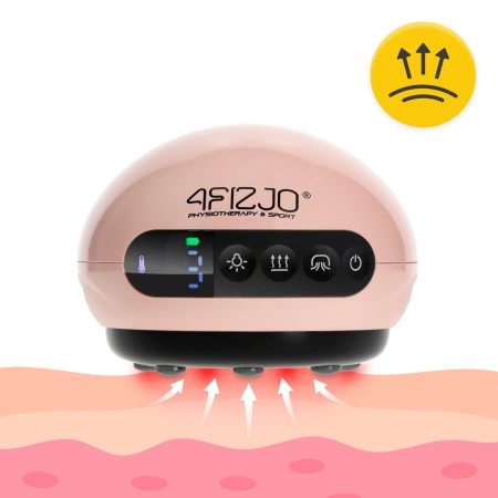 Ventuză chinezească electrică