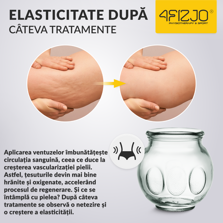 Ventuze cu foc din sticlă 20 buc.