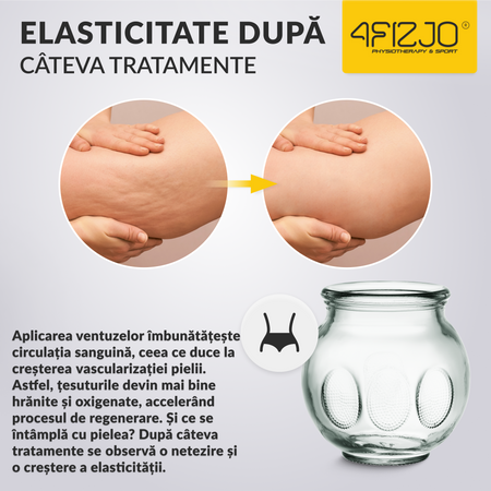 Ventuze cu foc din sticlă 12 buc.